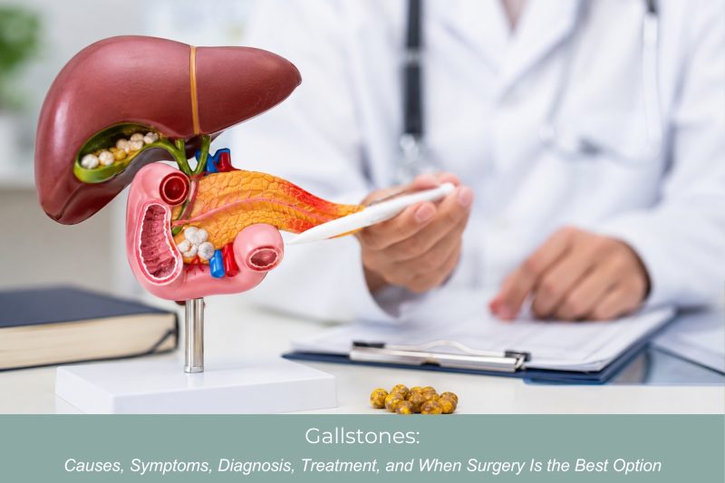 Gallstones Causes, Symptoms, Diagnosis, Treatment, and When Surgery Is the Best Option